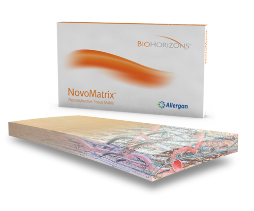 NovoMatrix – The next generation soft tissue augmentation material