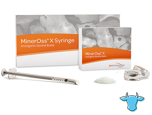 MinerOss X – Matrice inorganique osseuse bovine MinerOss X – Matrice inorganique osseuse bovine