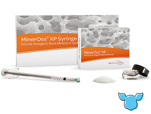 MinerOss XP – Matrice inorganique osseuse porcine MinerOss XP est un minéral osseux inorganique hautement poreux et spongieux d’origine porcine pour des augmentations osseuses.