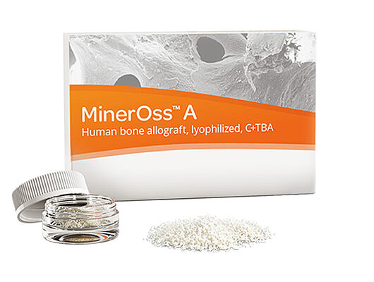 MinerOss A – l’alternative allogène aux greffes autogènes MinerOss A est une allogreffe fabriquée à partir de tissus osseux d’un sujet humain.