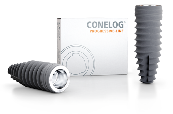 CONELOG PROGRESSIVE-LINE Implants – Developed to facilitate immediate treatment