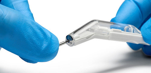 Bone Scraper Anwedung: drehbare Klinge Bone Scraper Anwedung: Mit einem 1.2-mm-Sechskant-Schraubendreher drehen Sie die Klinge des Knochenschabers, um ein neues scharfes Segment der Klinge in Gebrauch zu nehmen.