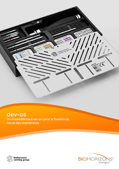 dev-os dépliant produit dev-os dépliant produit: Un ensemble tout-en-un pour la fixation de l’os et des membranes